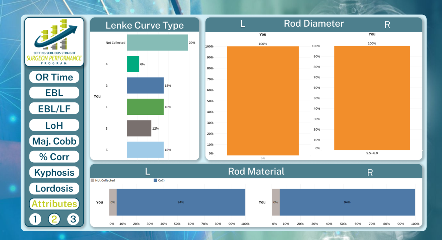 SPP Dashboard - 3